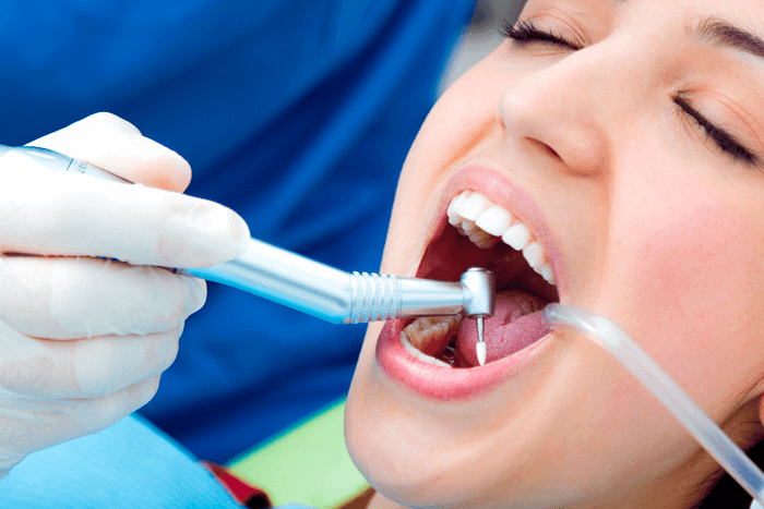 Facetas dentárias.